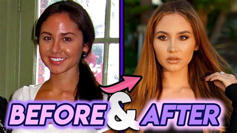 catherine paiz nose job|Catherine Paiz Is Engaged Now, Also Children